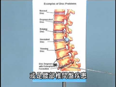 健生中醫 - 關心您的坐骨神經痛 - 0800092000